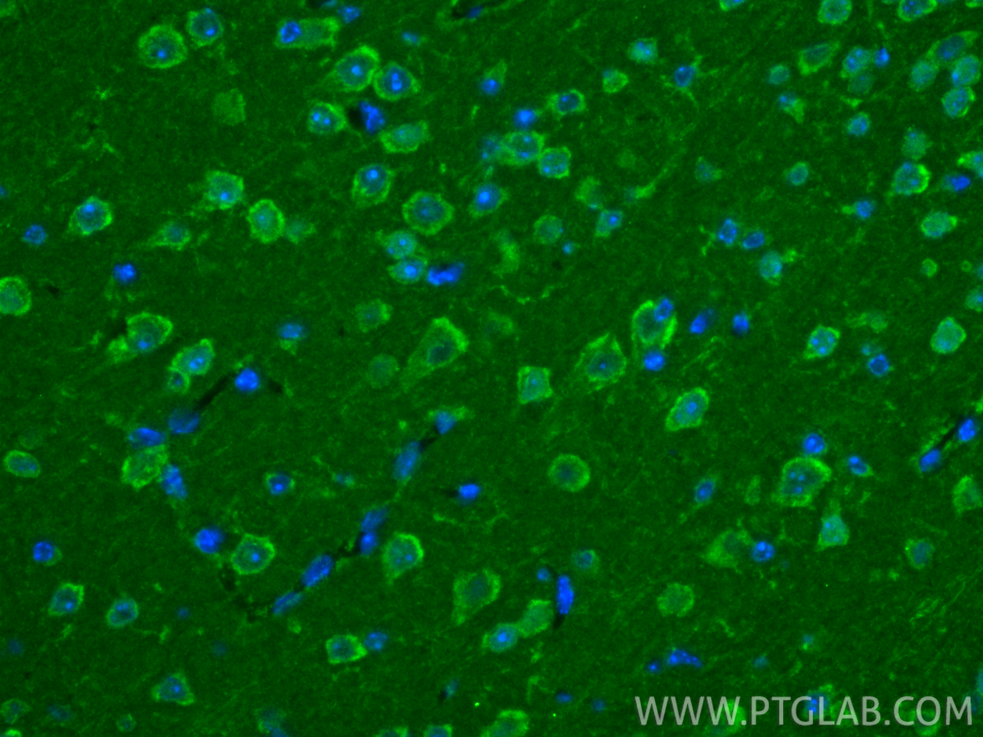 IF Staining of mouse brain using 12257-1-AP