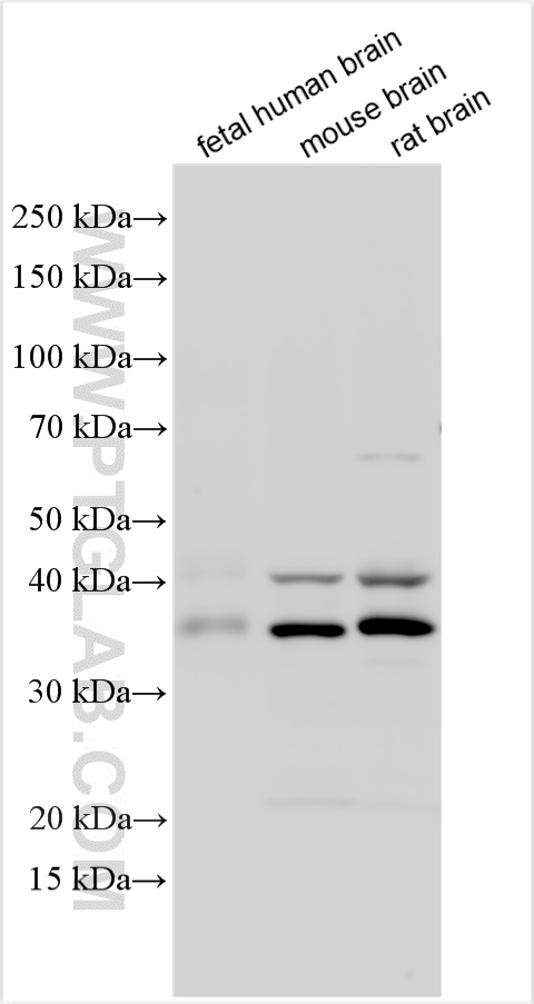 Various lysates were subjected to SDS PAGE followed by western blot with 12257-1-AP (NECAB2 antibody) at dilution of 1:5000 incubated at room temperature for 1.5 hours. WB analysis using 12257-1-AP