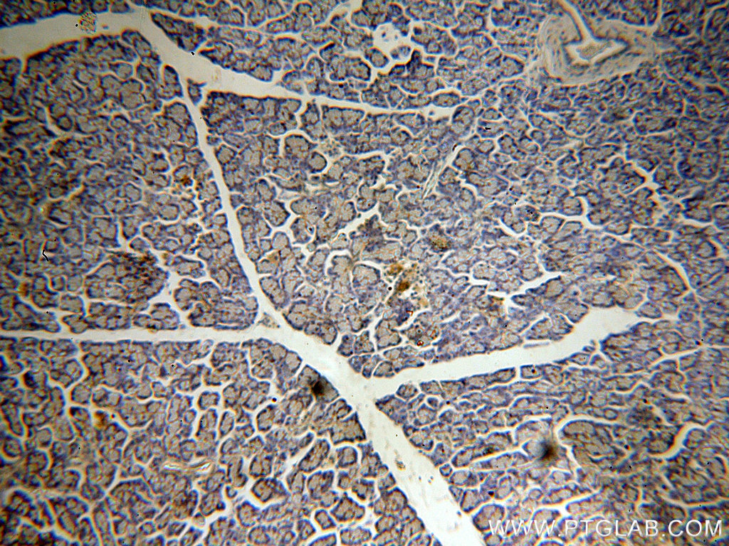 IHC staining of human pancreas using 18940-1-AP