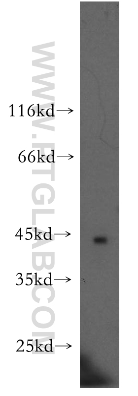 NECAB3