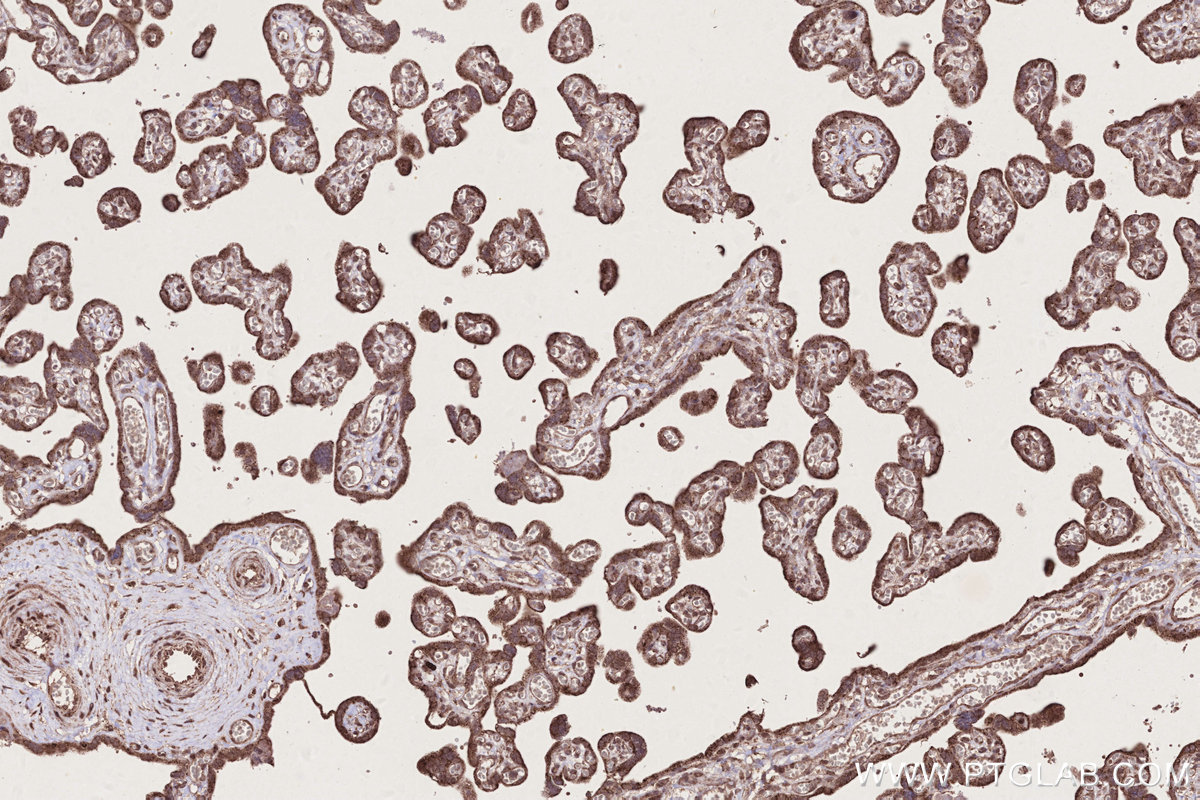IHC staining of human placenta using 13993-1-AP