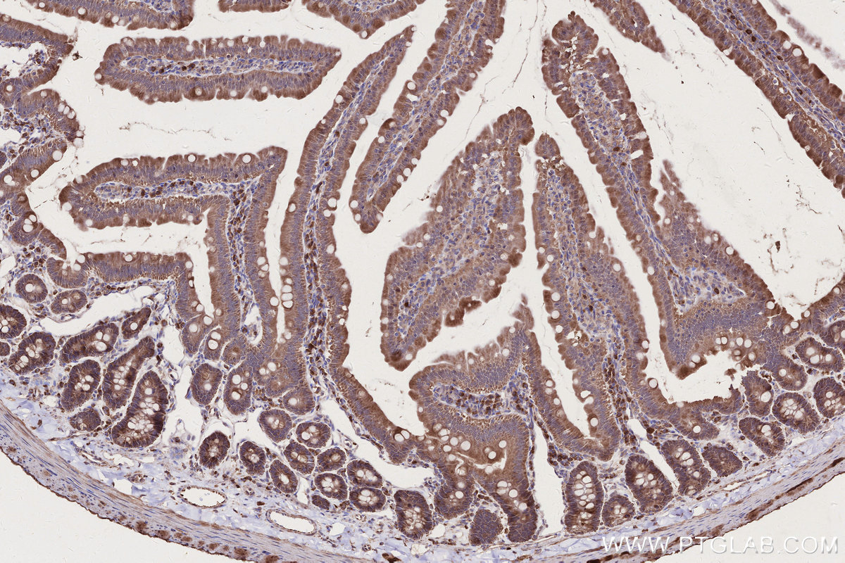 IHC staining of rat small intestine using 13993-1-AP