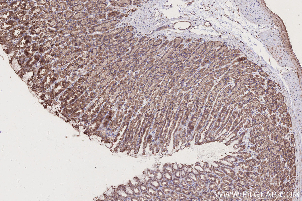 IHC staining of rat stomach using 13993-1-AP