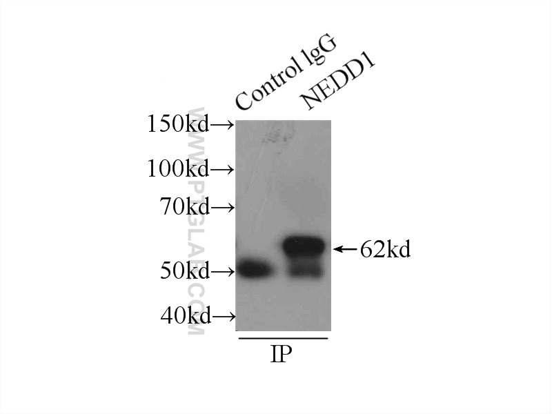 IP experiment of HeLa using 13993-1-AP