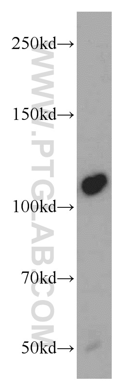 NEDD4 Polyclonal antibody