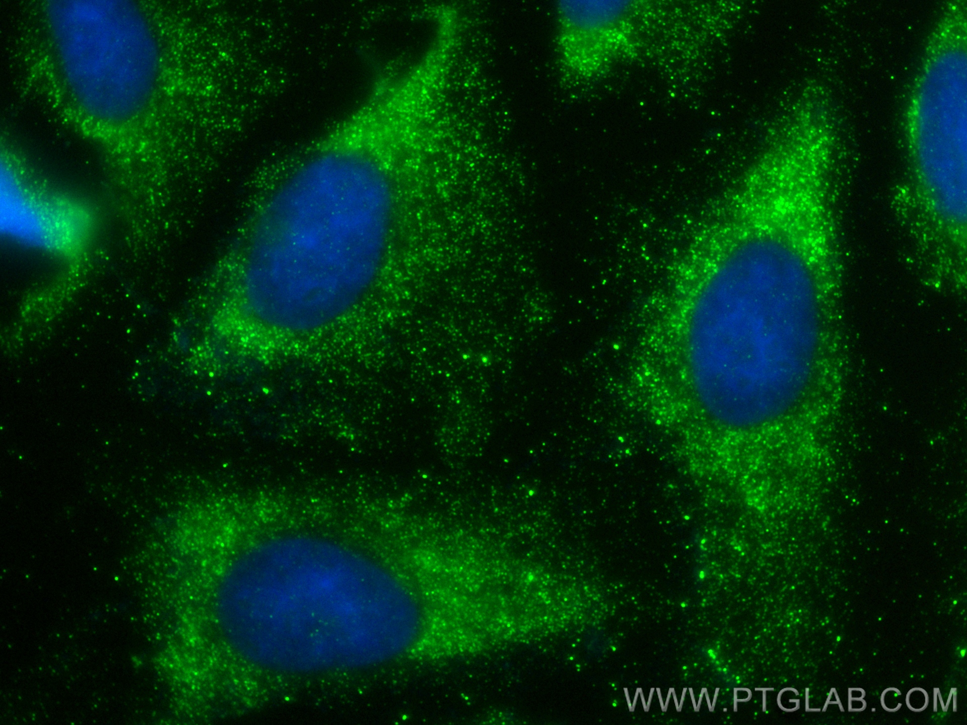 IF Staining of U2OS using 83112-1-RR