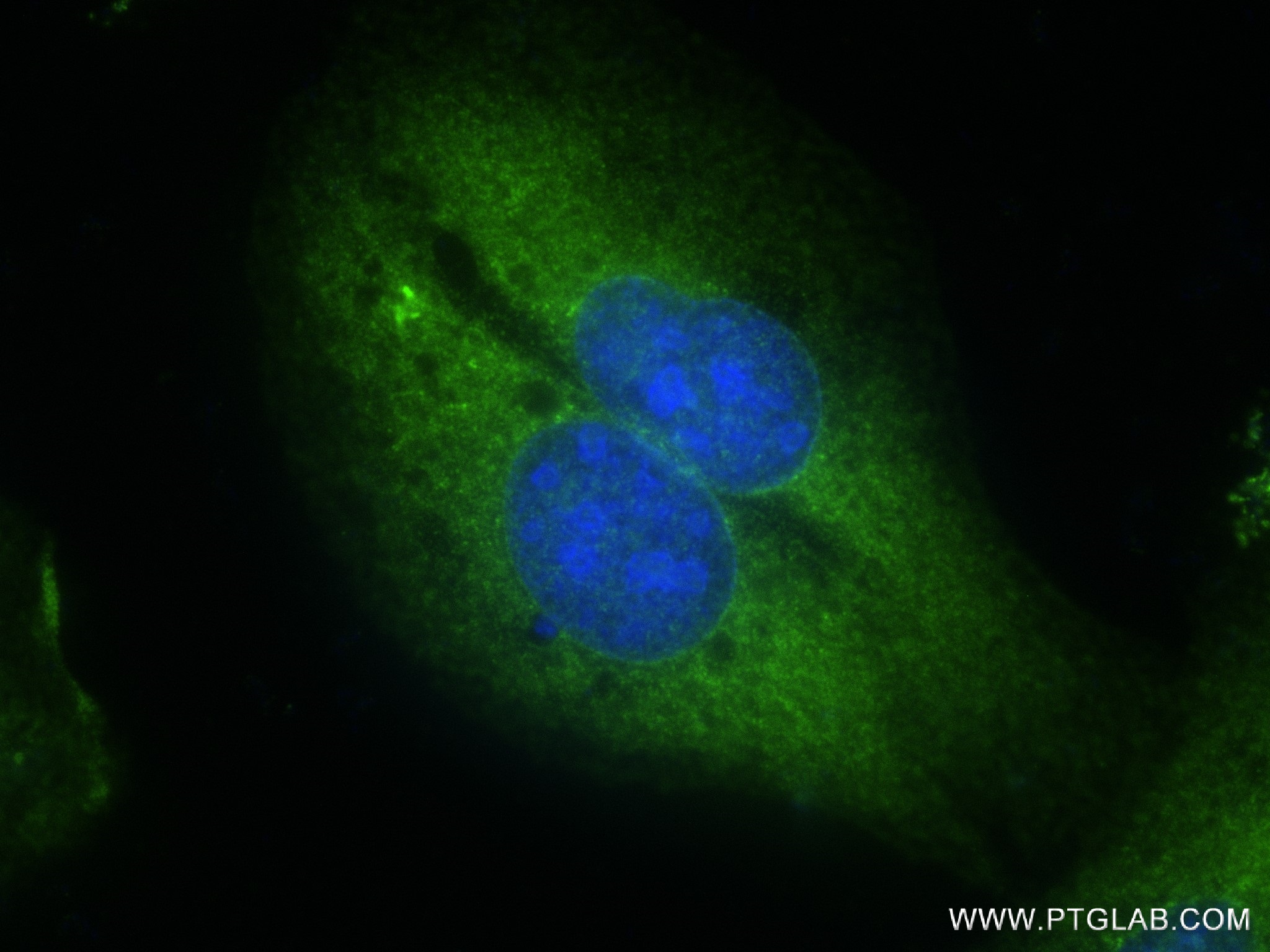 IF Staining of U2OS using 83112-4-RR (same clone as 83112-4-PBS)