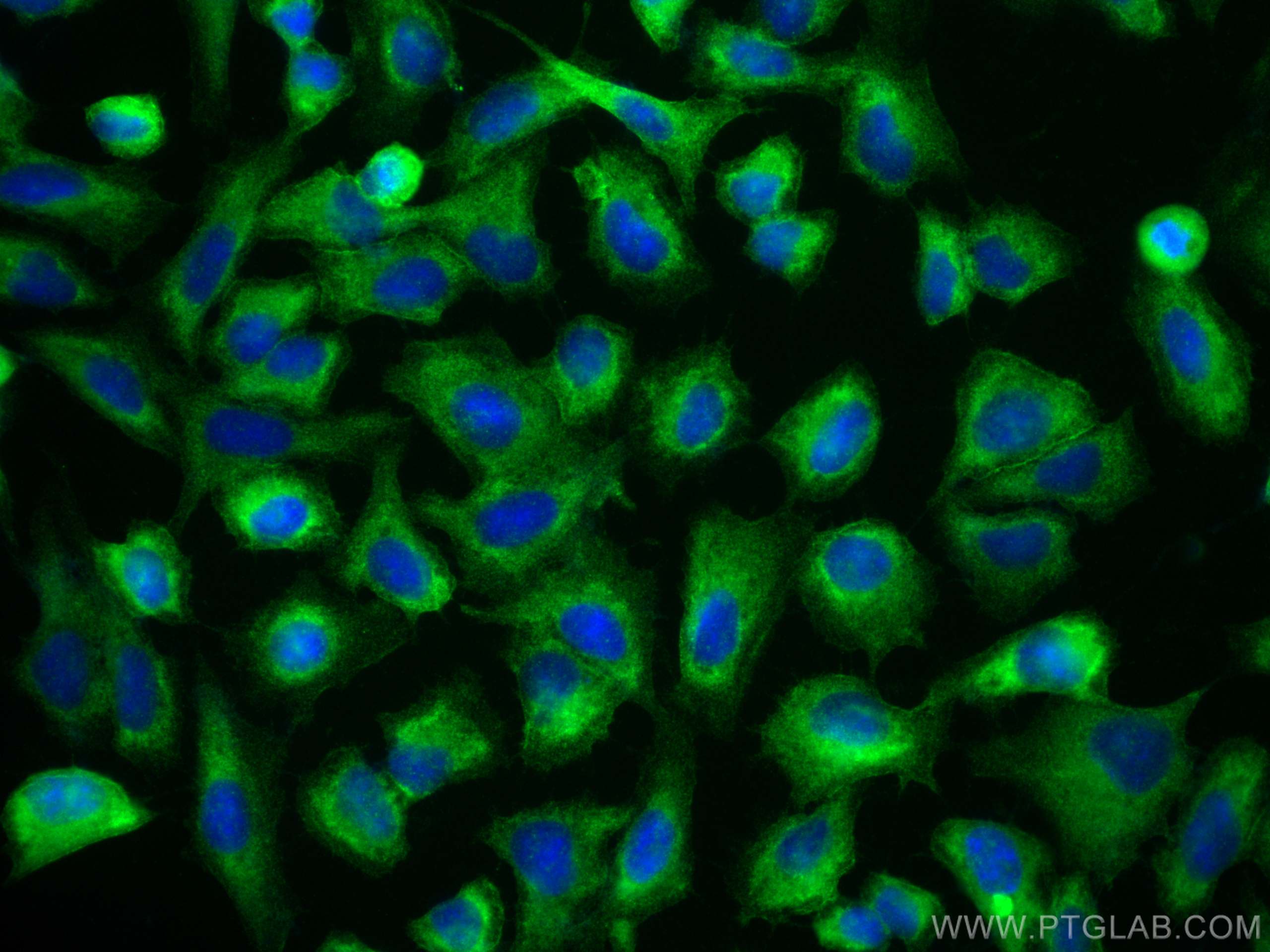 IF Staining of U2OS using 83112-4-RR (same clone as 83112-4-PBS)