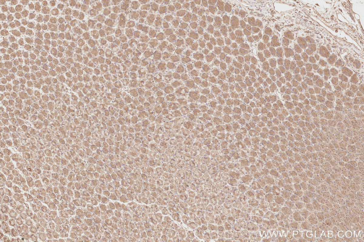 IHC staining of rat stomach using 13690-1-AP