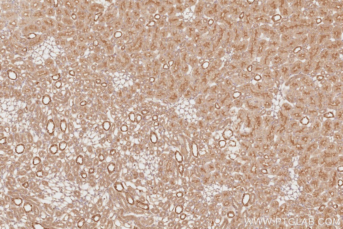 IHC staining of rat kidney using 13690-1-AP