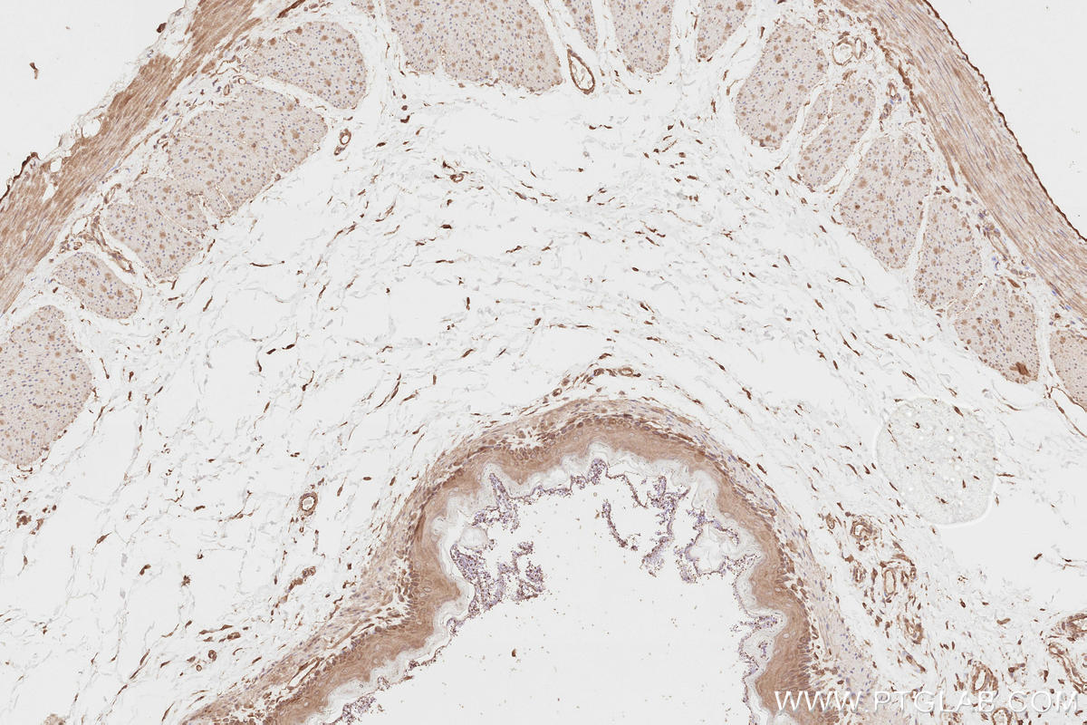 IHC staining of rat stomach using 13690-1-AP