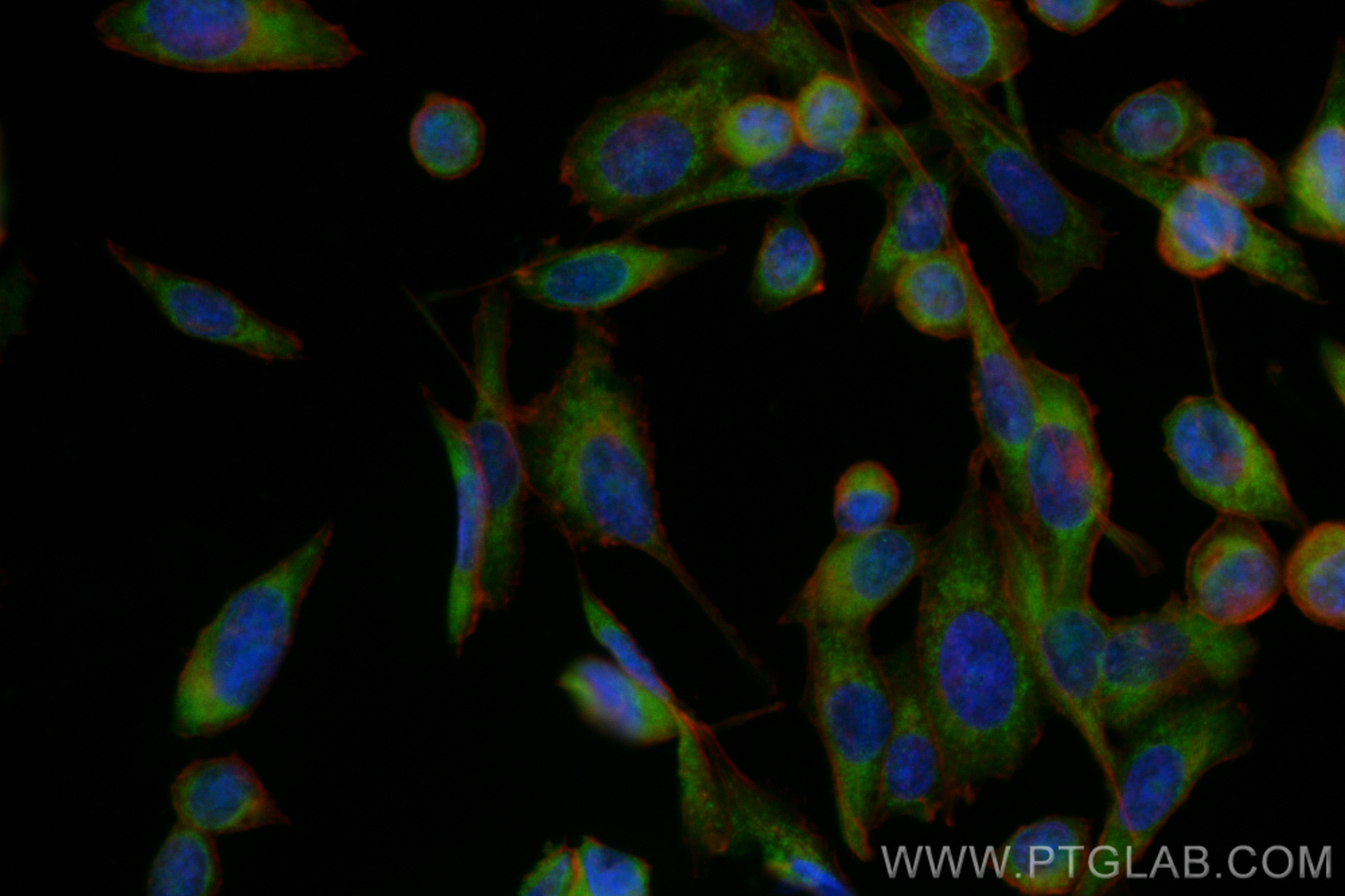 IF Staining of PC-3 using CL488-13690