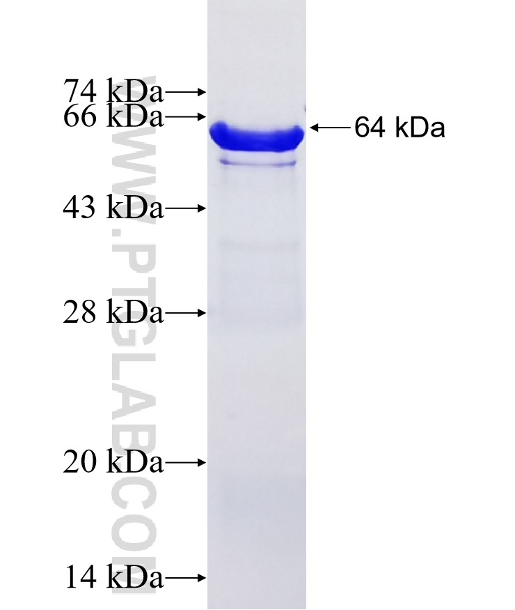 NEDD4L fusion protein Ag4565 SDS-PAGE