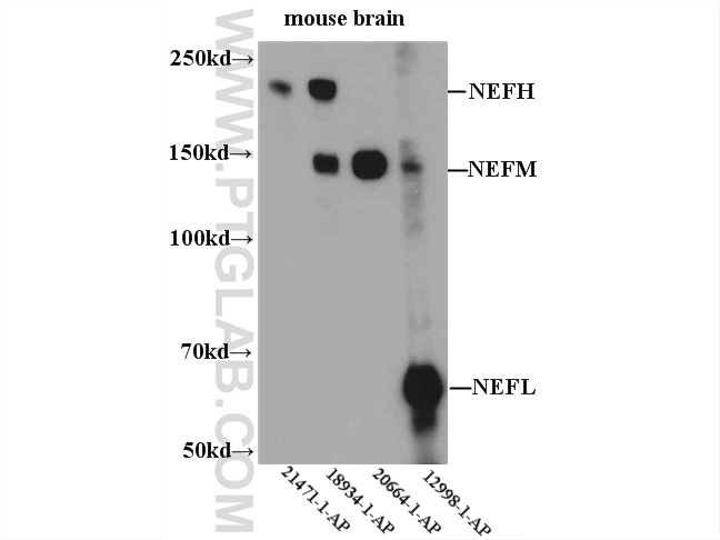 WB analysis of mouse brain tissue using 18934-1-AP (same clone as 18934-1-PBS)