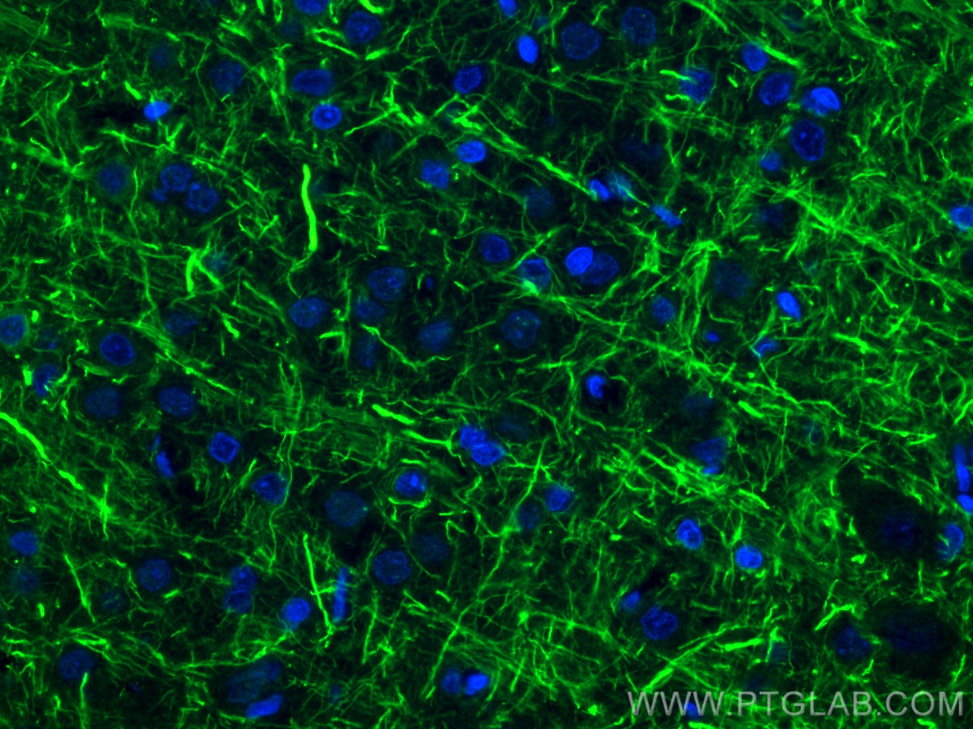 IF Staining of rat brain using 18934-1-AP (same clone as 18934-1-PBS)