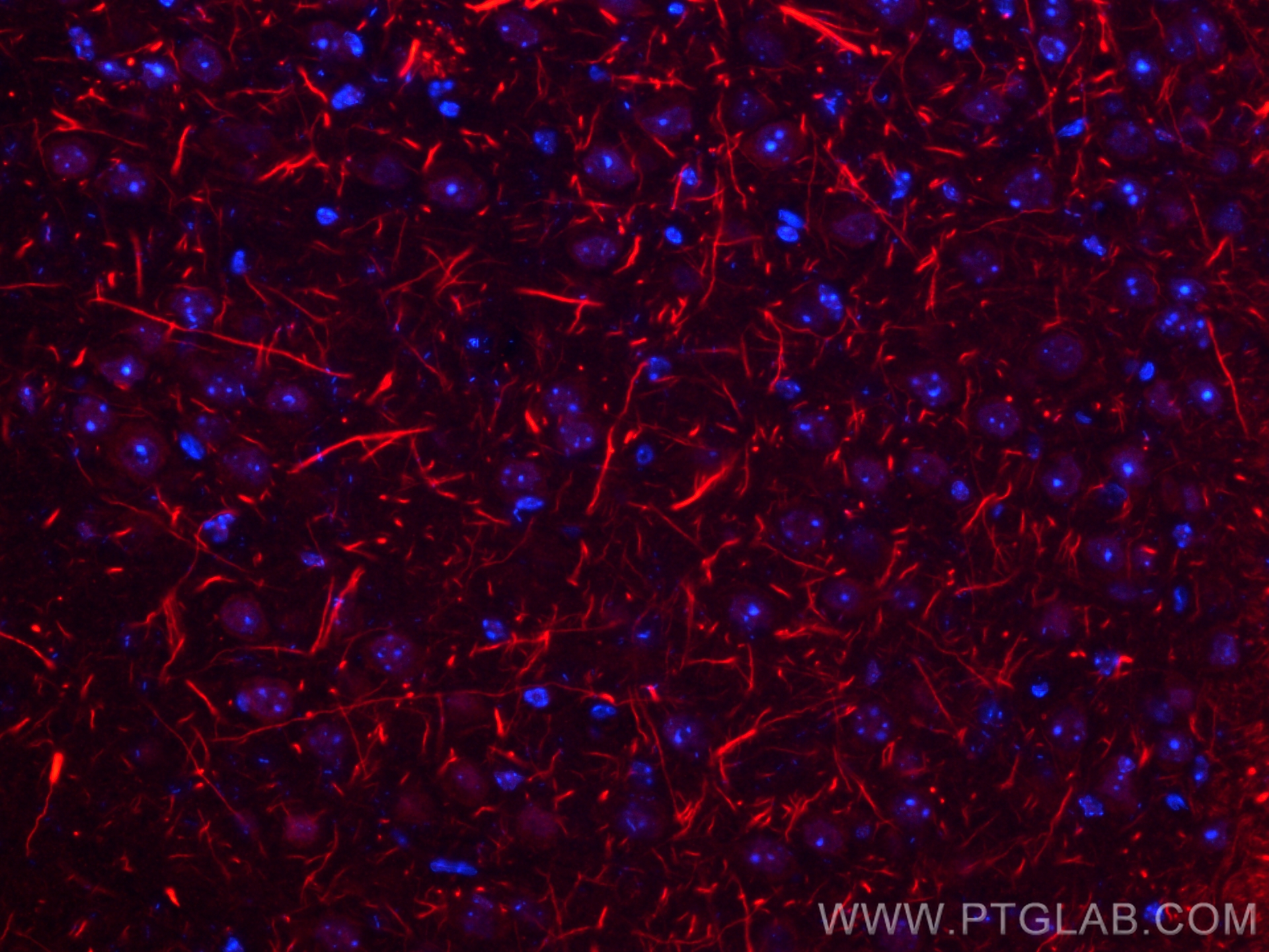 IF Staining of mouse brain using 18934-1-AP (same clone as 18934-1-PBS)