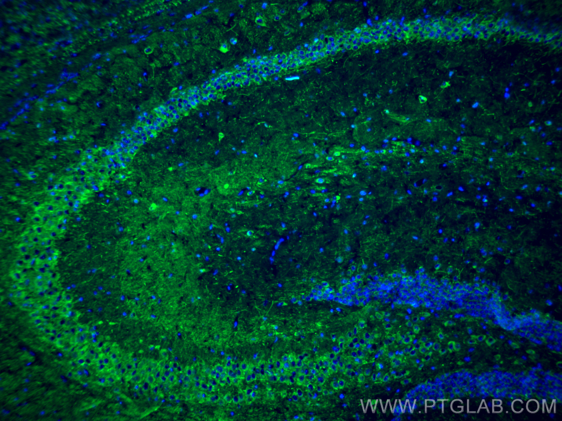 IF Staining of mouse brain using 18934-1-AP