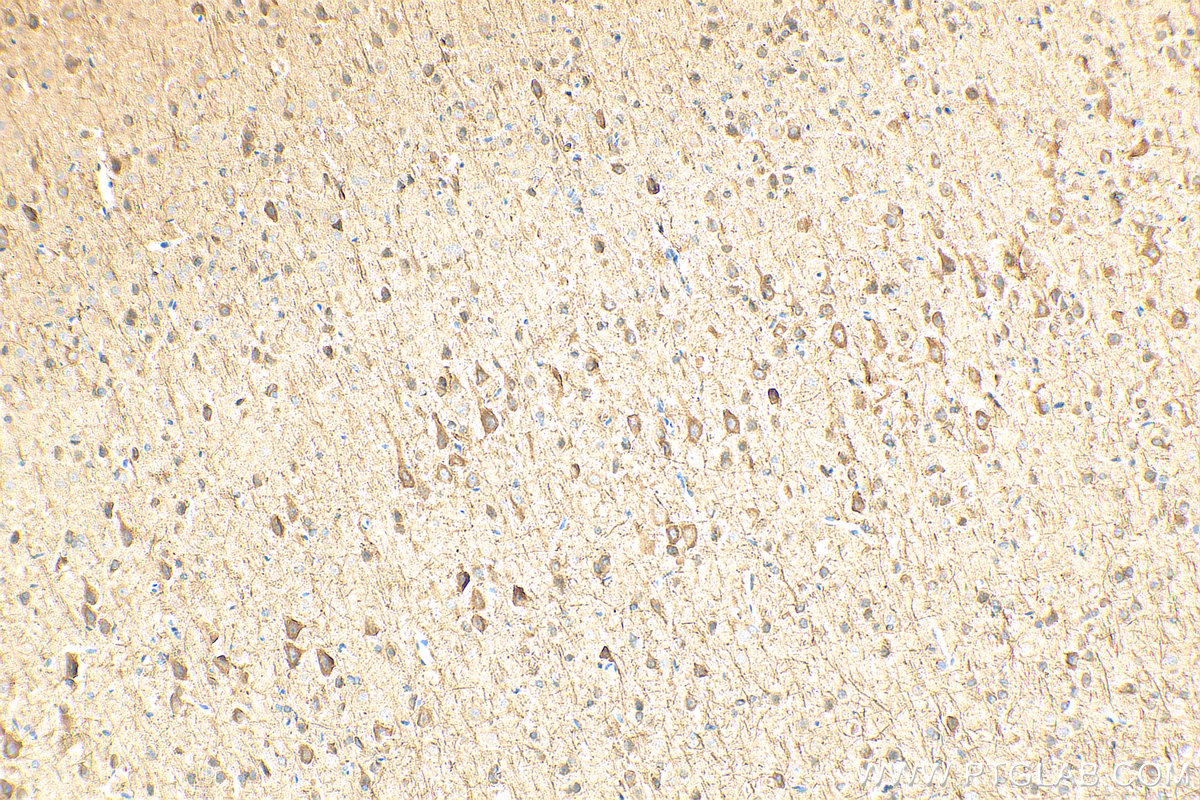 IHC staining of rat brain using 18934-1-AP