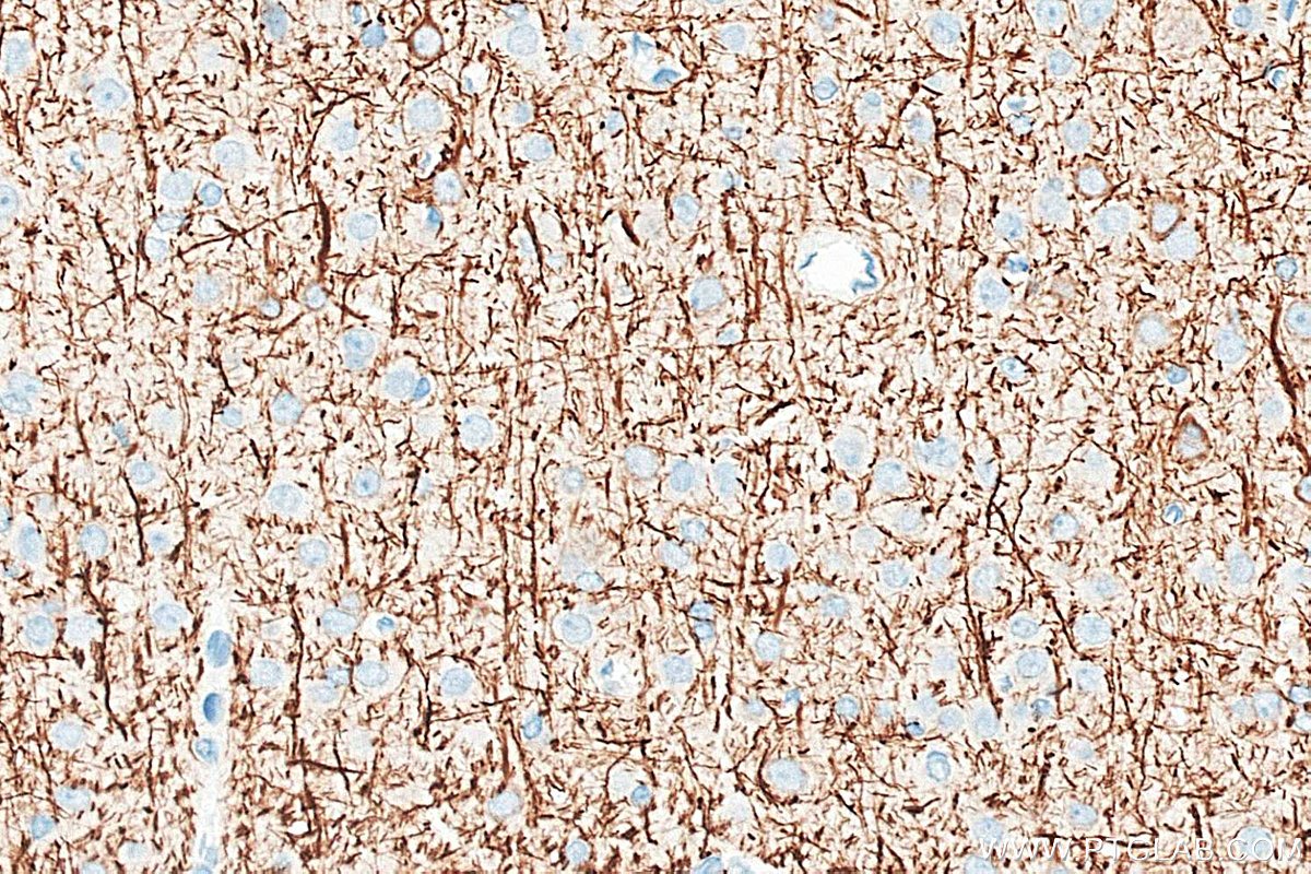 IHC staining of rat brain using 18934-1-AP IHC staining of rat brain using 18934-1-AP