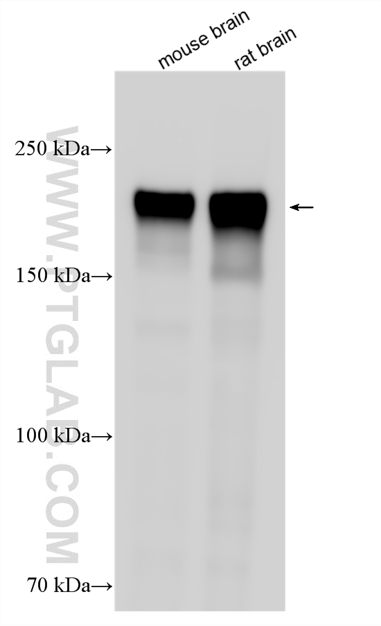 Various lysates were subjected to SDS PAGE followed by western blot with 18934-1-AP (NF-H/NF200 antibody) at dilution of 1:30000 incubated at room temperature for 1.5 hours. WB analysis using 18934-1-AP