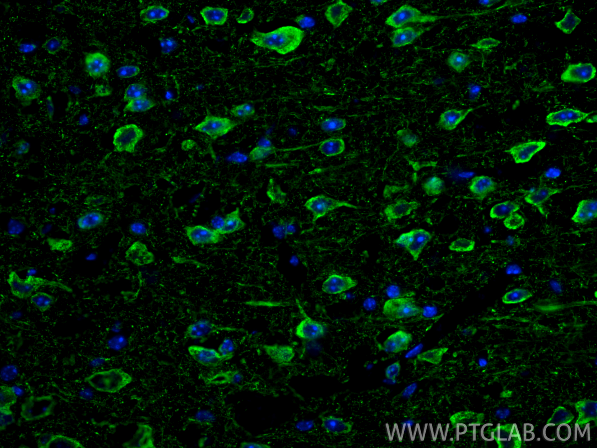 IF Staining of mouse brain using 21471-1-AP IF Staining of mouse brain using 21471-1-AP