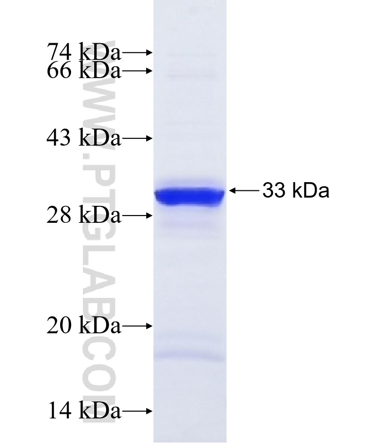 NF200 fusion protein Ag13520 SDS-PAGE NF200 fusion protein Ag13520 SDS-PAGE