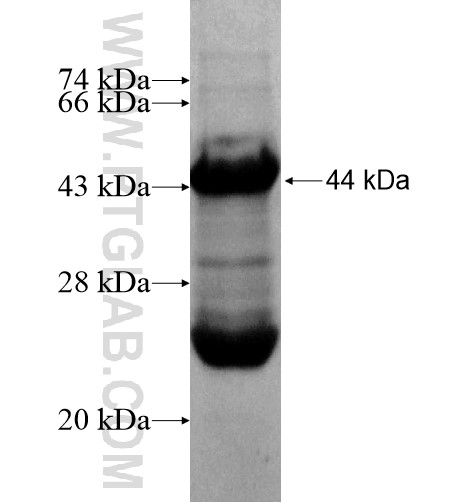 NEFH fusion protein Ag15249 SDS-PAGE