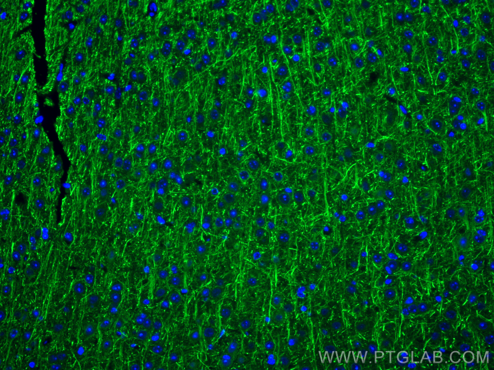 IF Staining of mouse brain using 12998-1-AP