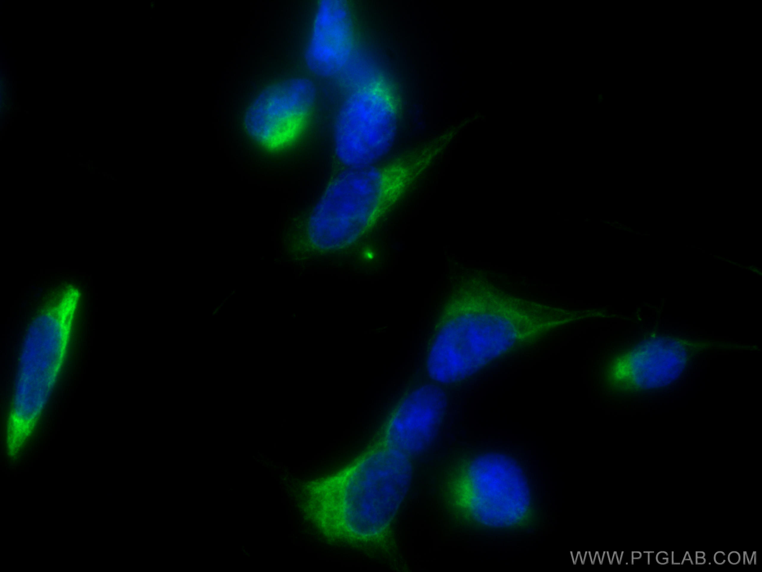 IF Staining of SH-SY5Y using 12998-1-AP