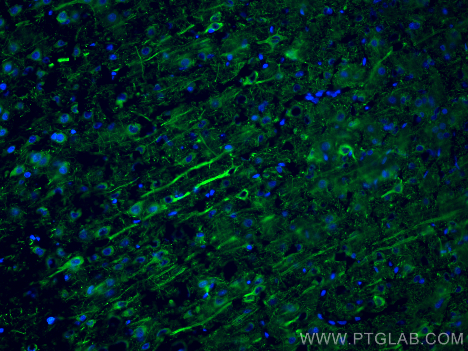Immunofluorescent analysis of (4% PFA) fixed frozen OCT-embedded rat brain tissue using NF-L antibody (12998-1-AP) at dilution of 1:800 and CoraLite®488-Conjugated Goat Anti-Rabbit IgG(H+L) (<a class='green' href='/productredirect?CatalogNo=SA00013-2' target='_blank'>SA00013-2</a>). IF Staining of rat brain using 12998-1-AP