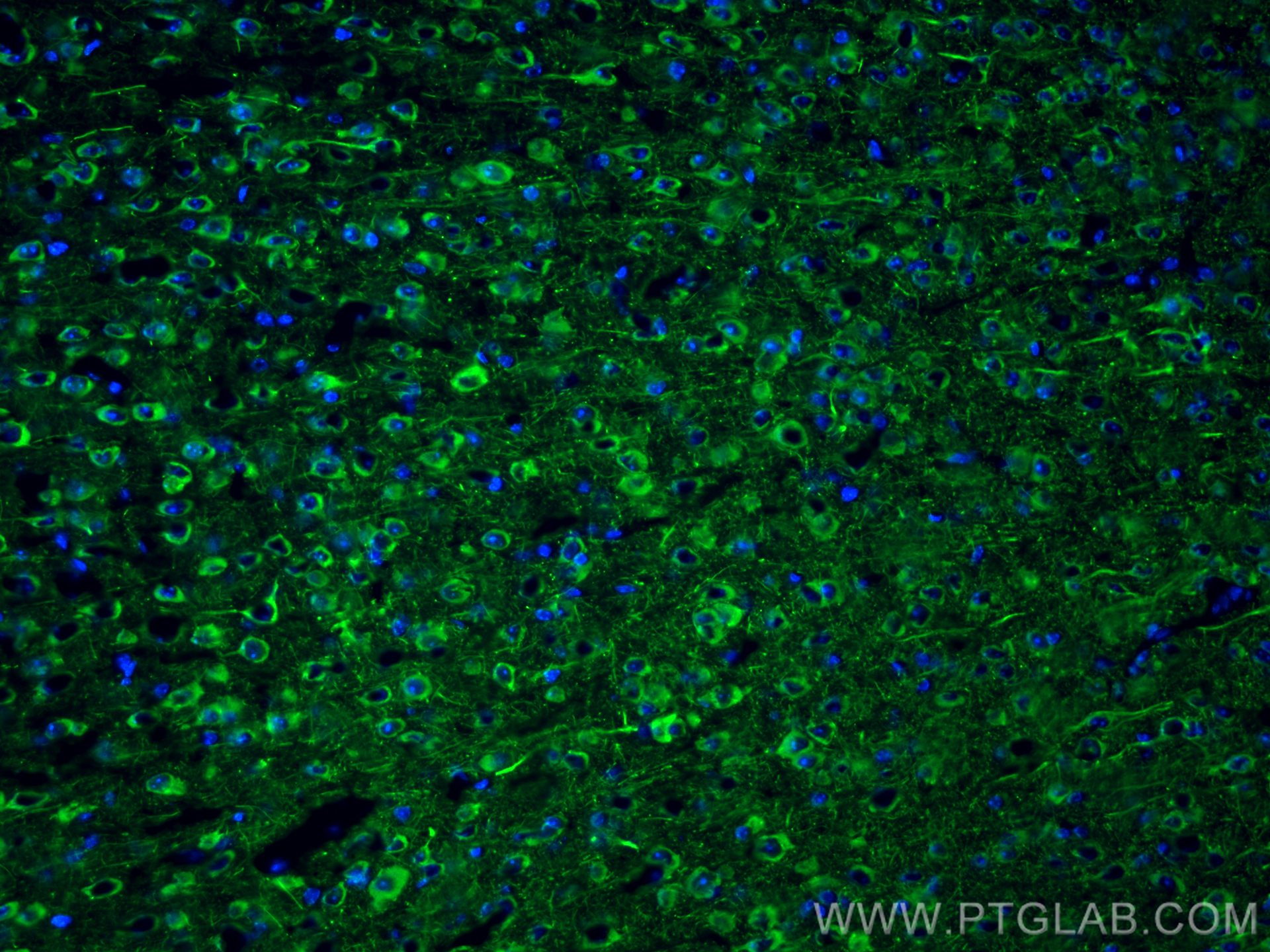 Immunofluorescent analysis of (4% PFA) fixed frozen OCT-embedded mouse brain tissue using NF-L antibody (12998-1-AP) at dilution of 1:800 and CoraLite®488-Conjugated Goat Anti-Rabbit IgG(H+L) (<a class='green' href='/productredirect?CatalogNo=SA00013-2' target='_blank'>SA00013-2</a>). IF Staining of mouse brain using 12998-1-AP