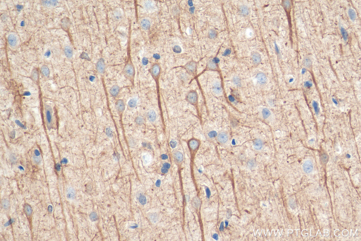 IHC staining of rat brain using 60189-1-Ig (same clone as 60189-1-PBS)