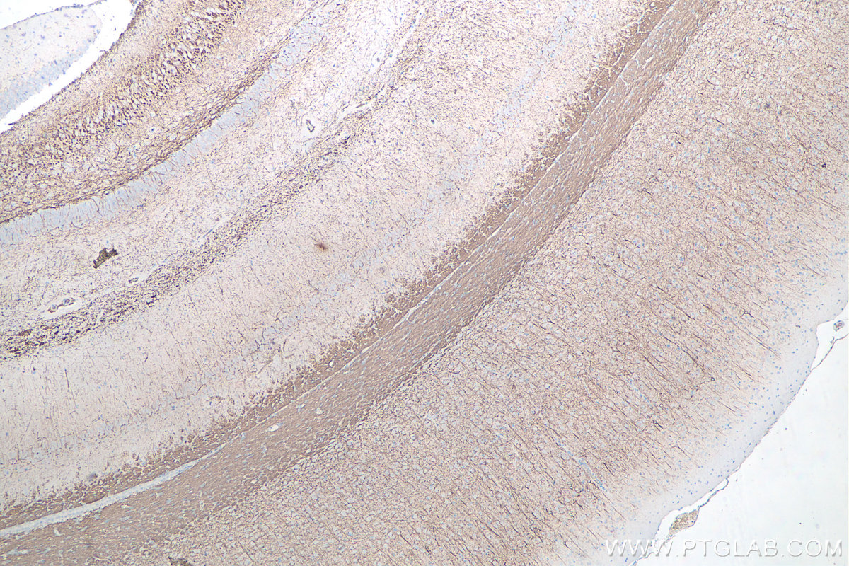 IHC staining of rat brain using 60189-1-Ig