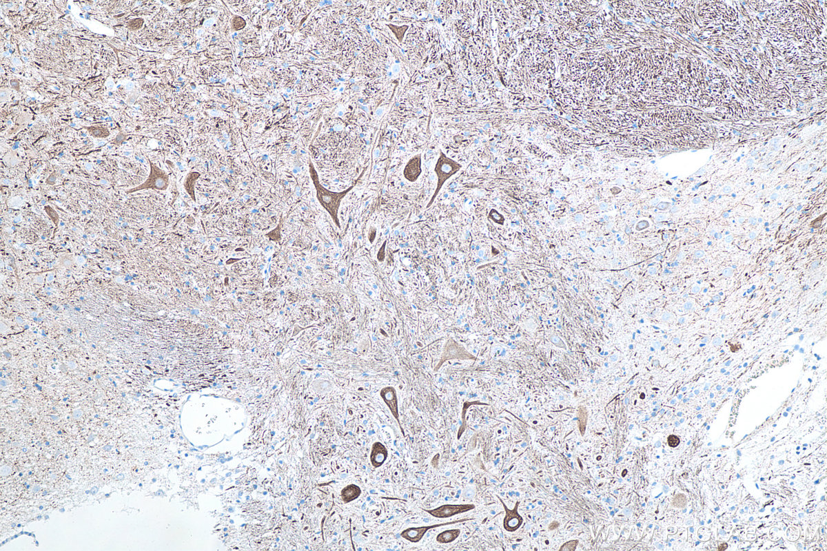 IHC staining of rat cerebellum using 60189-1-Ig