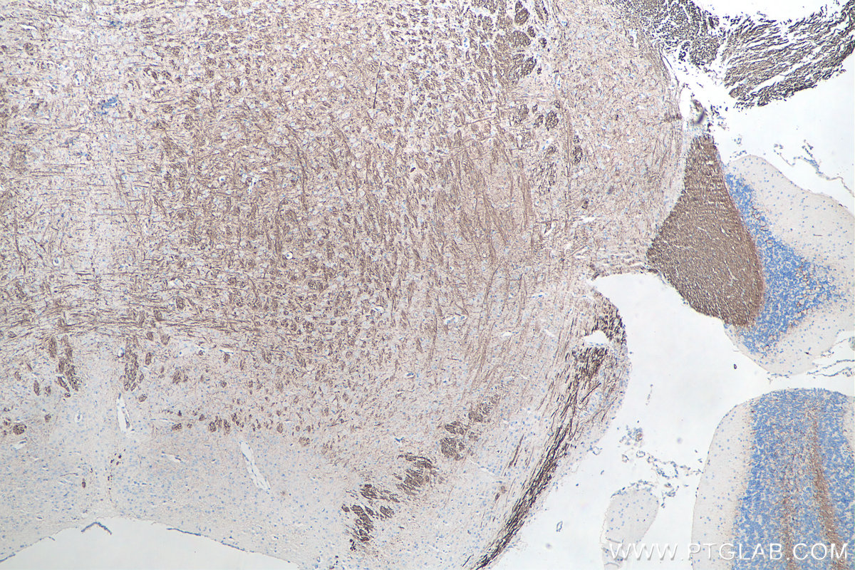 IHC staining of mouse cerebellum using 60189-1-Ig