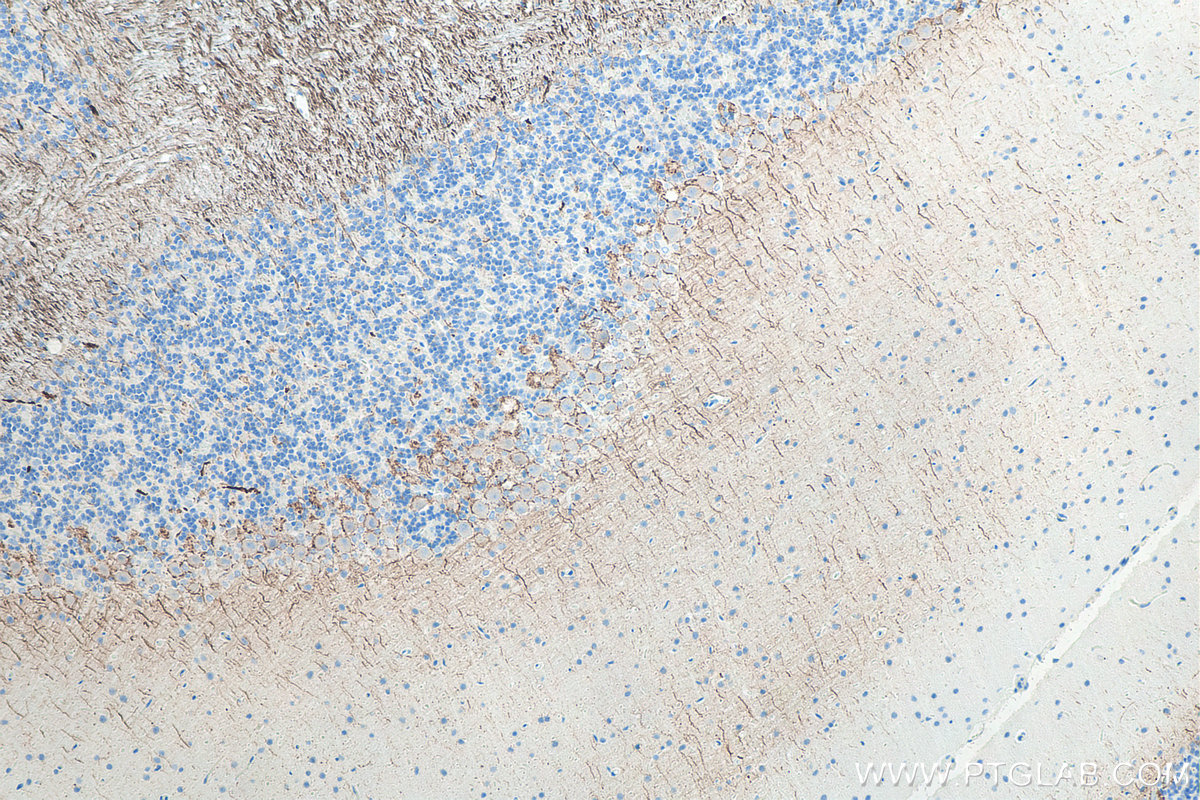 IHC staining of rat cerebellum using 60189-1-Ig