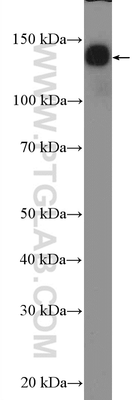 NF-M Polyclonal antibody