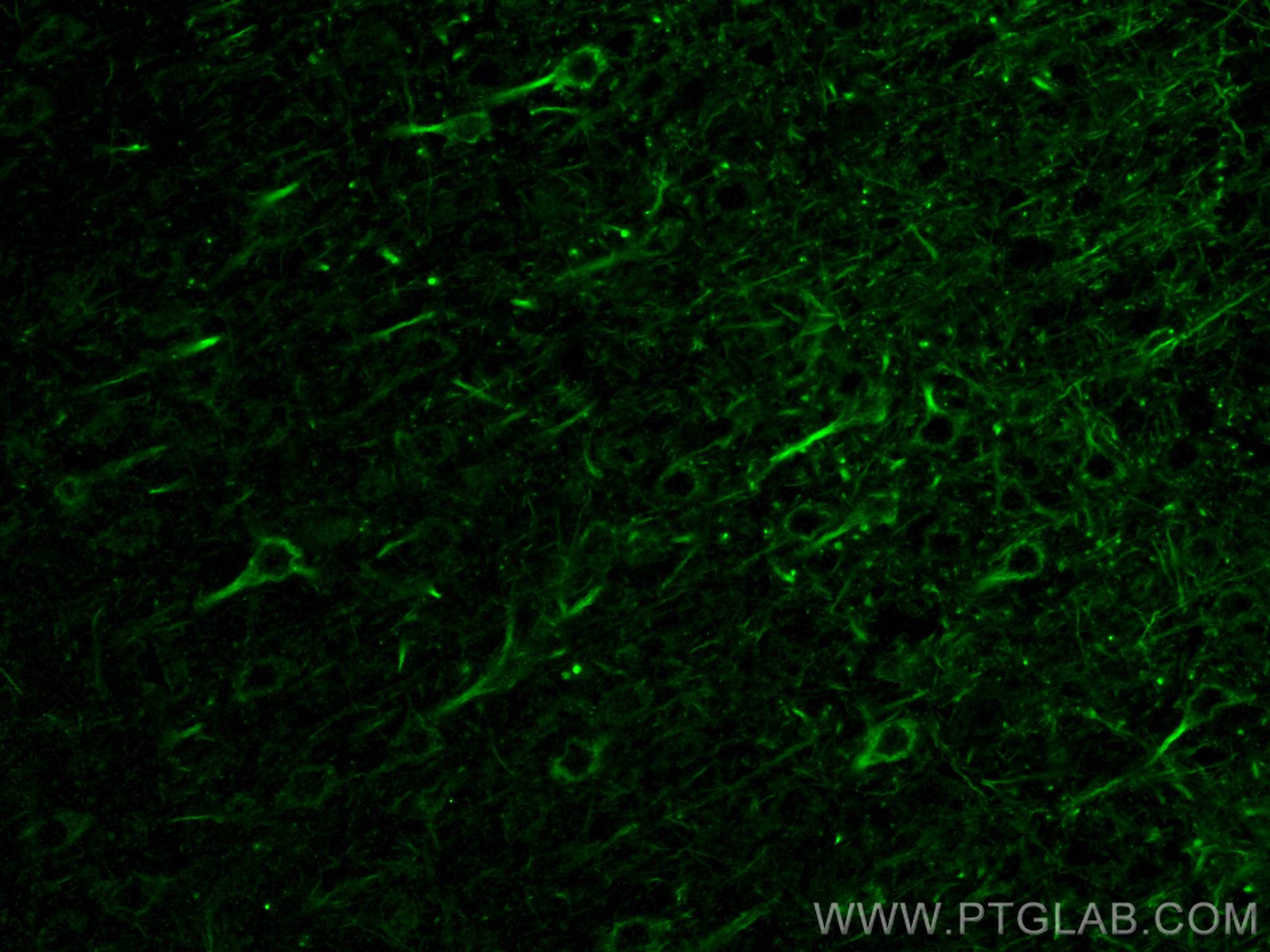 Immunofluorescent analysis of (4% PFA) fixed paraffin-embedded mouse brain tissue using NF-M antibody (66396-1-Ig, Clone: 2E3B12 ) at dilution of 1:400 and CoraLite®488-Conjugated AffiniPure Goat Anti-Mouse IgG(H+L) (<a class='green' href='/productredirect?CatalogNo=SA00013-1' target='_blank'>SA00013-1</a>). Heat mediated antigen retrieval with Tris-EDTA buffer (pH 9.0). IF Staining of mouse brain using 66396-1-Ig