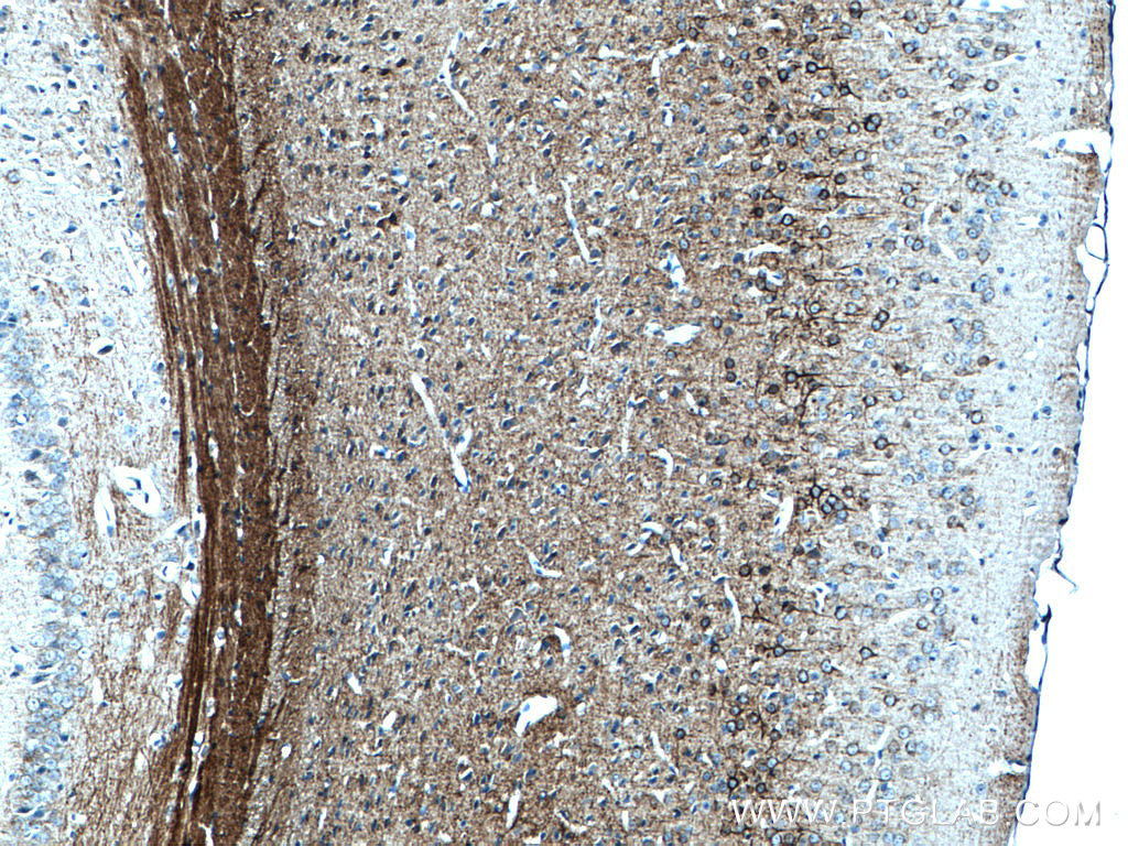 IHC staining of mouse brain using 66396-1-Ig (same clone as 66396-1-PBS)