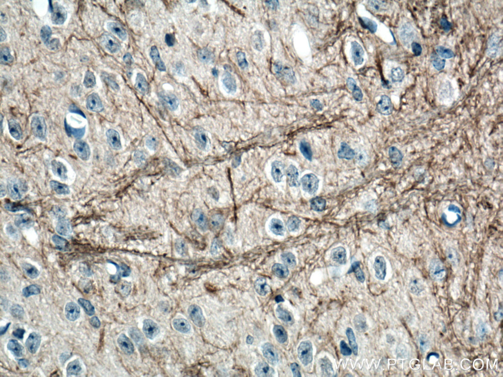 IHC staining of mouse cerebellum using 66396-1-Ig (same clone as 66396-1-PBS)