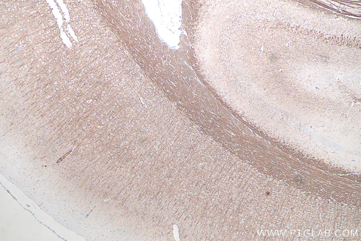 IHC staining of rat brain using 66396-1-Ig IHC staining of rat brain using 66396-1-Ig