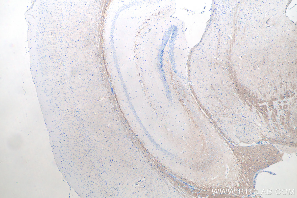 IHC staining of mouse brain using 66396-1-Ig IHC staining of mouse brain using 66396-1-Ig