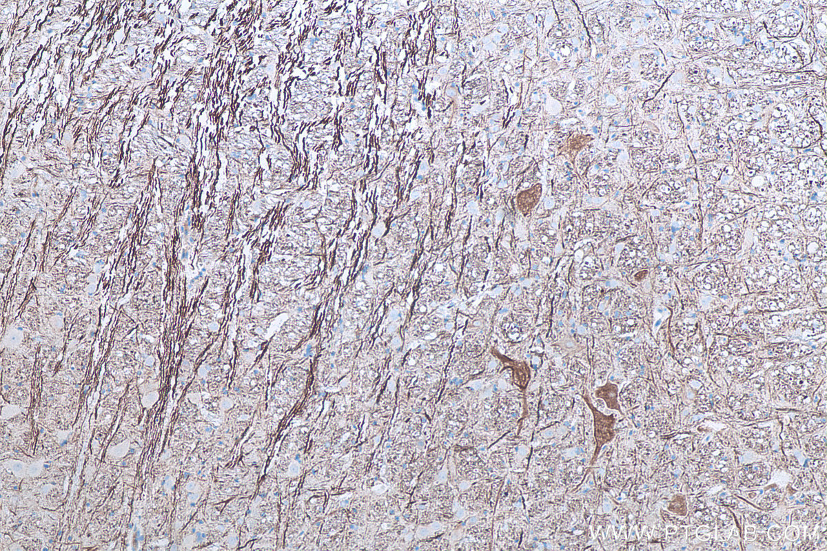 IHC staining of rat cerebellum using 66396-1-Ig IHC staining of rat cerebellum using 66396-1-Ig