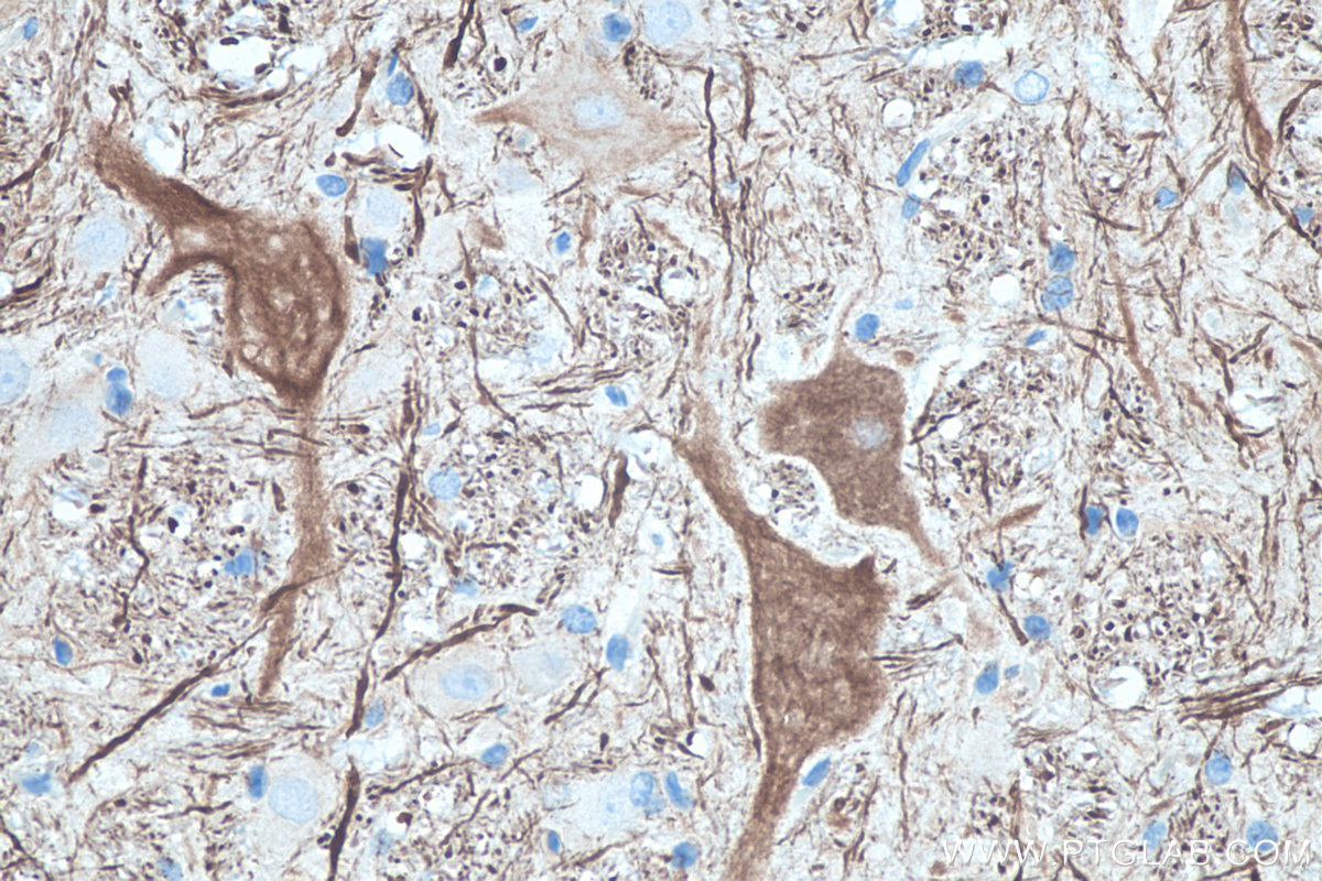 IHC staining of rat cerebellum using 66396-1-Ig IHC staining of rat cerebellum using 66396-1-Ig