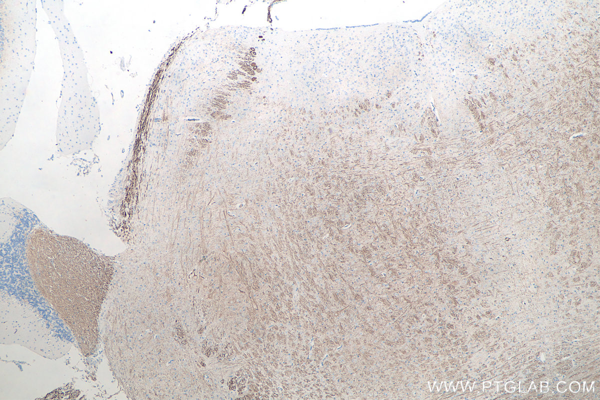 IHC staining of mouse cerebellum using 66396-1-Ig IHC staining of mouse cerebellum using 66396-1-Ig