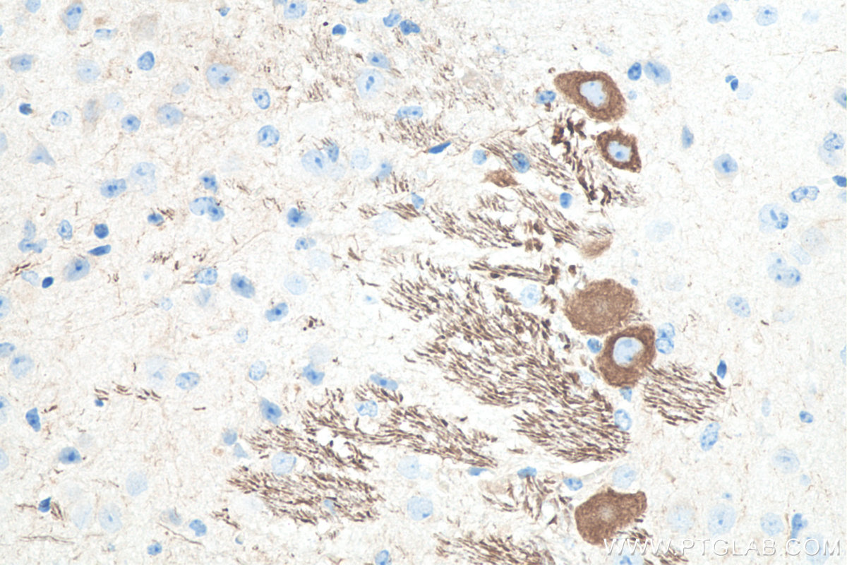 IHC staining of mouse cerebellum using 66396-1-Ig IHC staining of mouse cerebellum using 66396-1-Ig