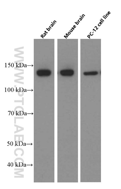 WB analysis of rat brain using 66396-1-Ig (same clone as 66396-1-PBS)