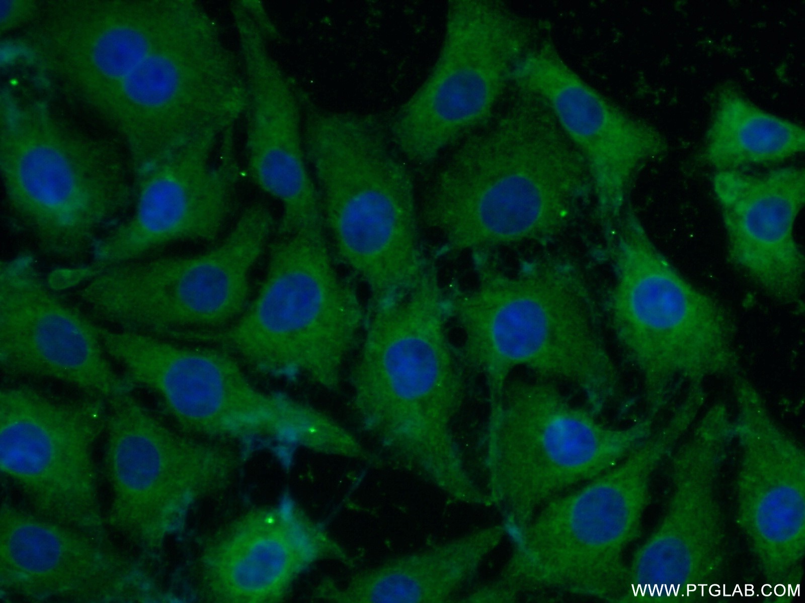 IF Staining of SH-SY5Y using 20664-1-AP