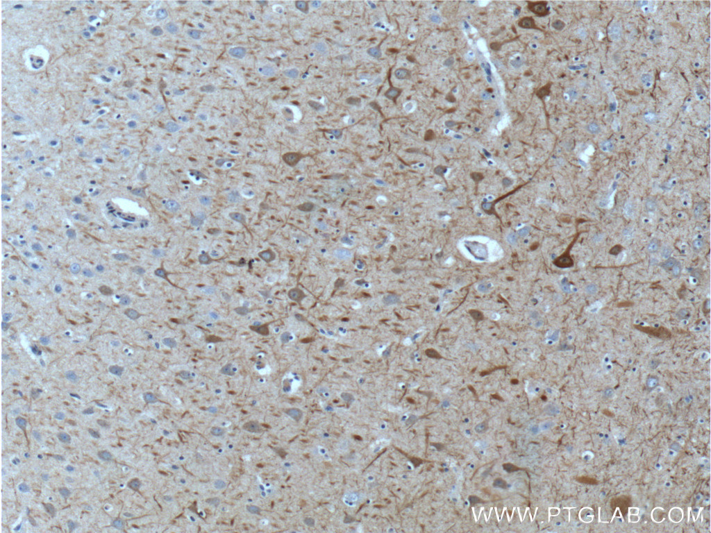 NF-M-Specific Polyclonal antibody