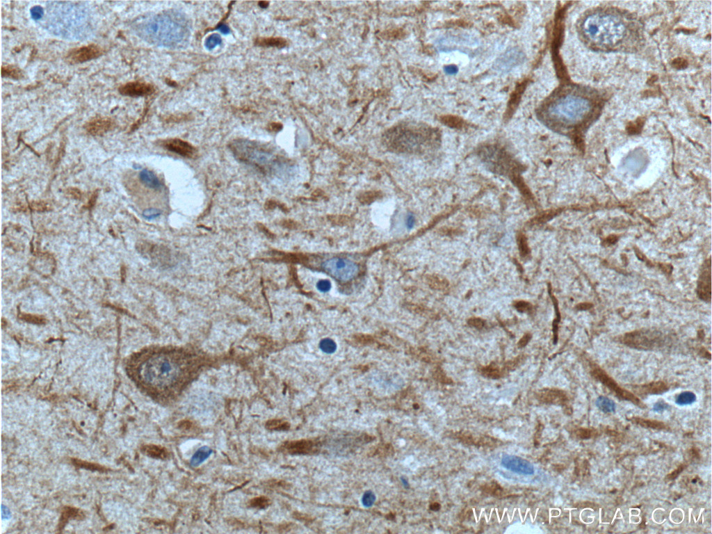 IHC staining of human brain using 20664-1-AP